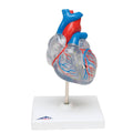 Classic Heart with Conducting System N73694